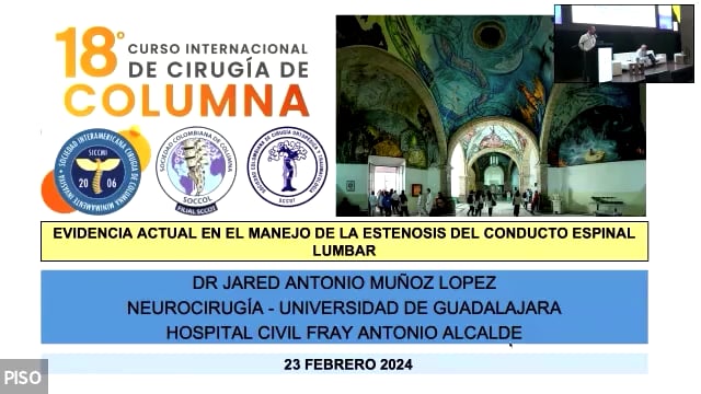 Actualidades en el manejo de la estenosis del conducto espinal lumbar