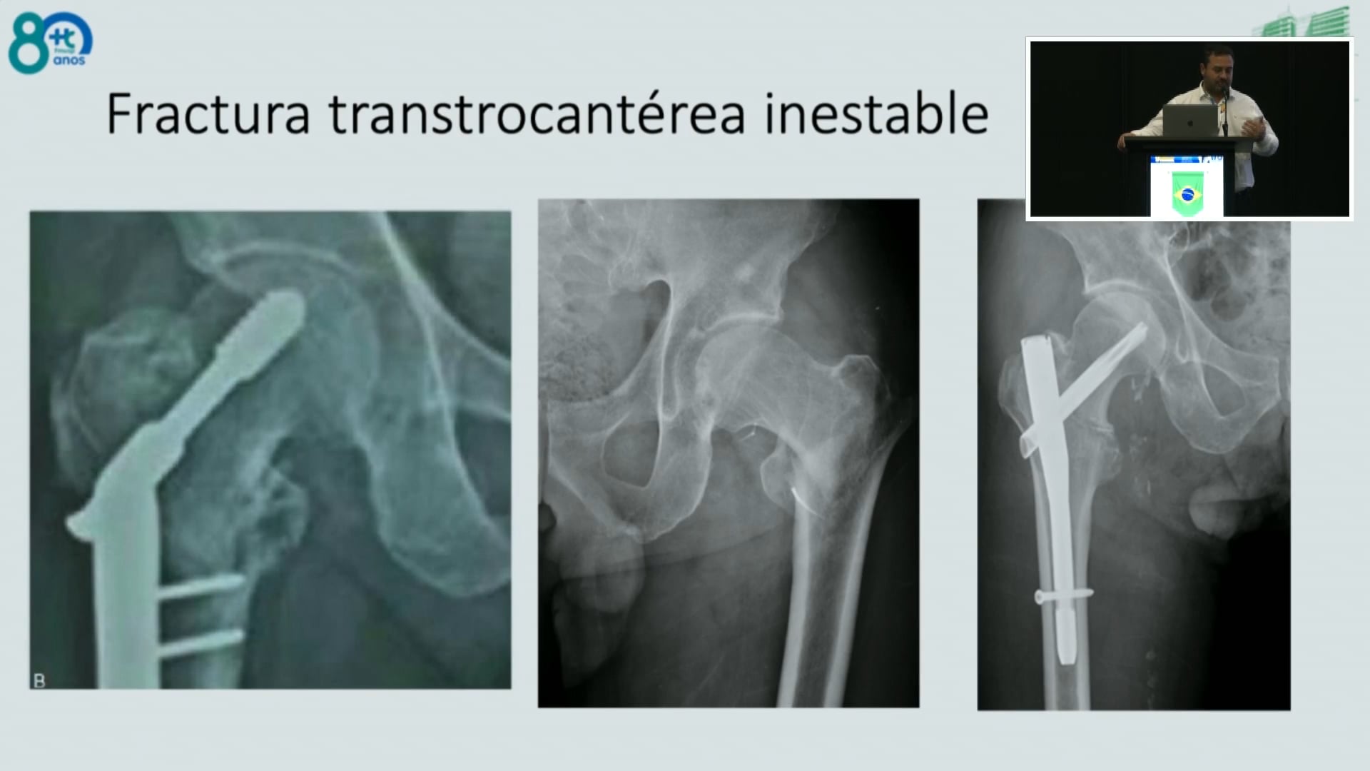 Innovación traducida en resultados clínicos Lo más nuevo es lo mejor