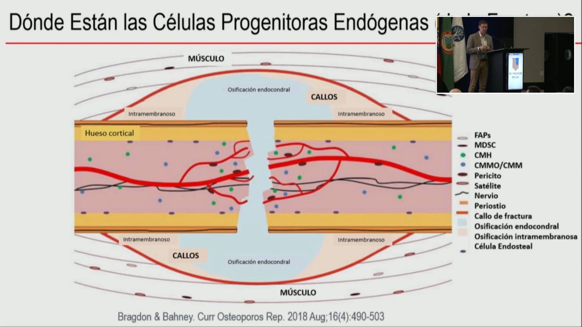 Terapia regenerativa y células madre en Trauma ortopédico Cuál es la evidencia
