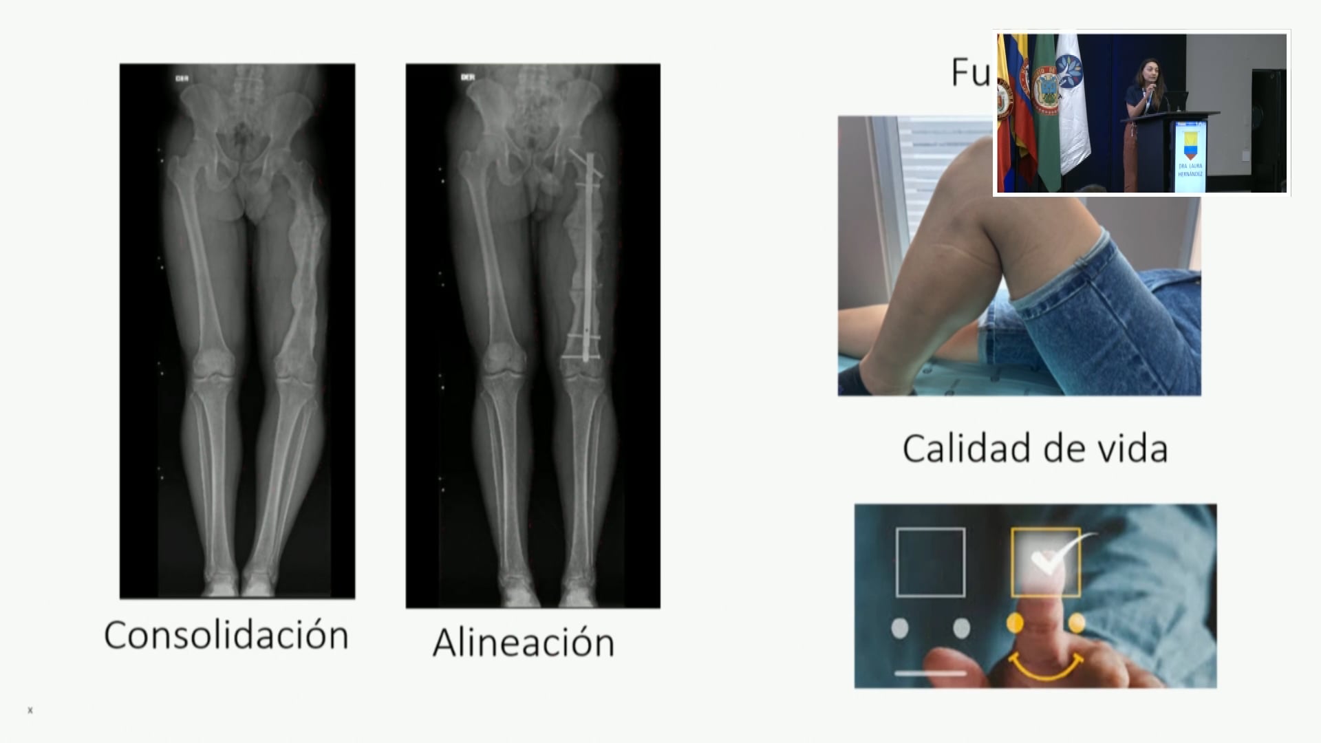 Resultados informados por los pacientes de PROMS: ¿Cuál es su utilidad?