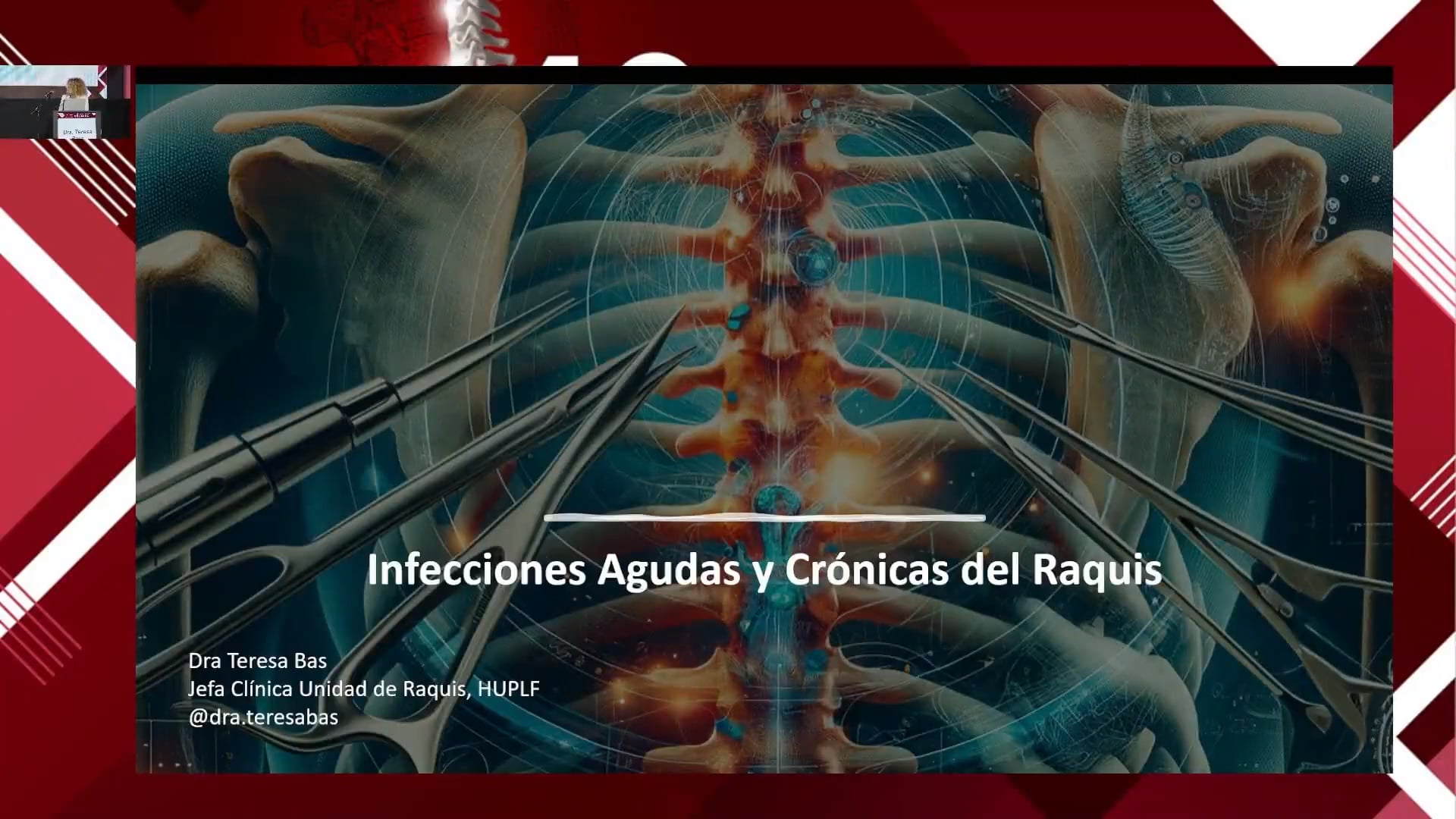 Infecciones crónicas y agudas de raquis