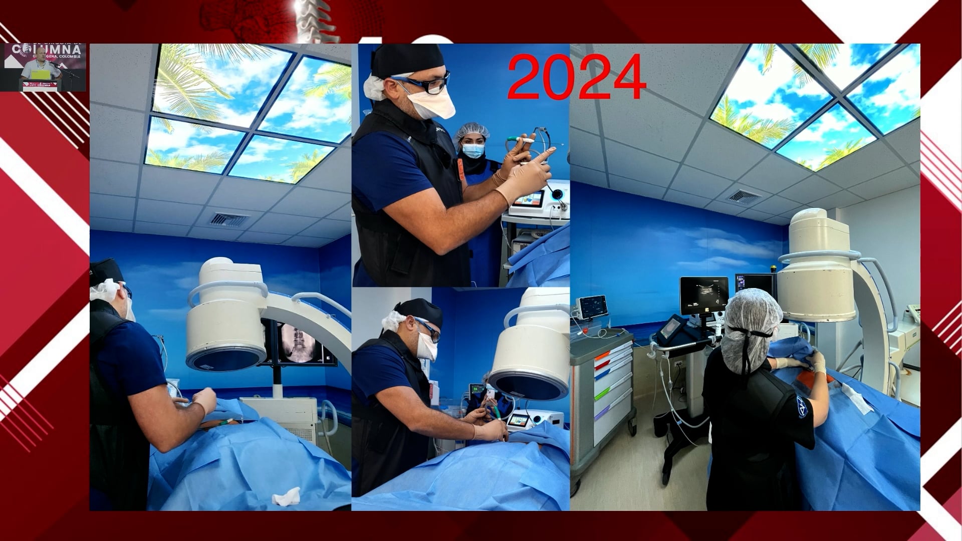 Crioterapia en dolor espinal