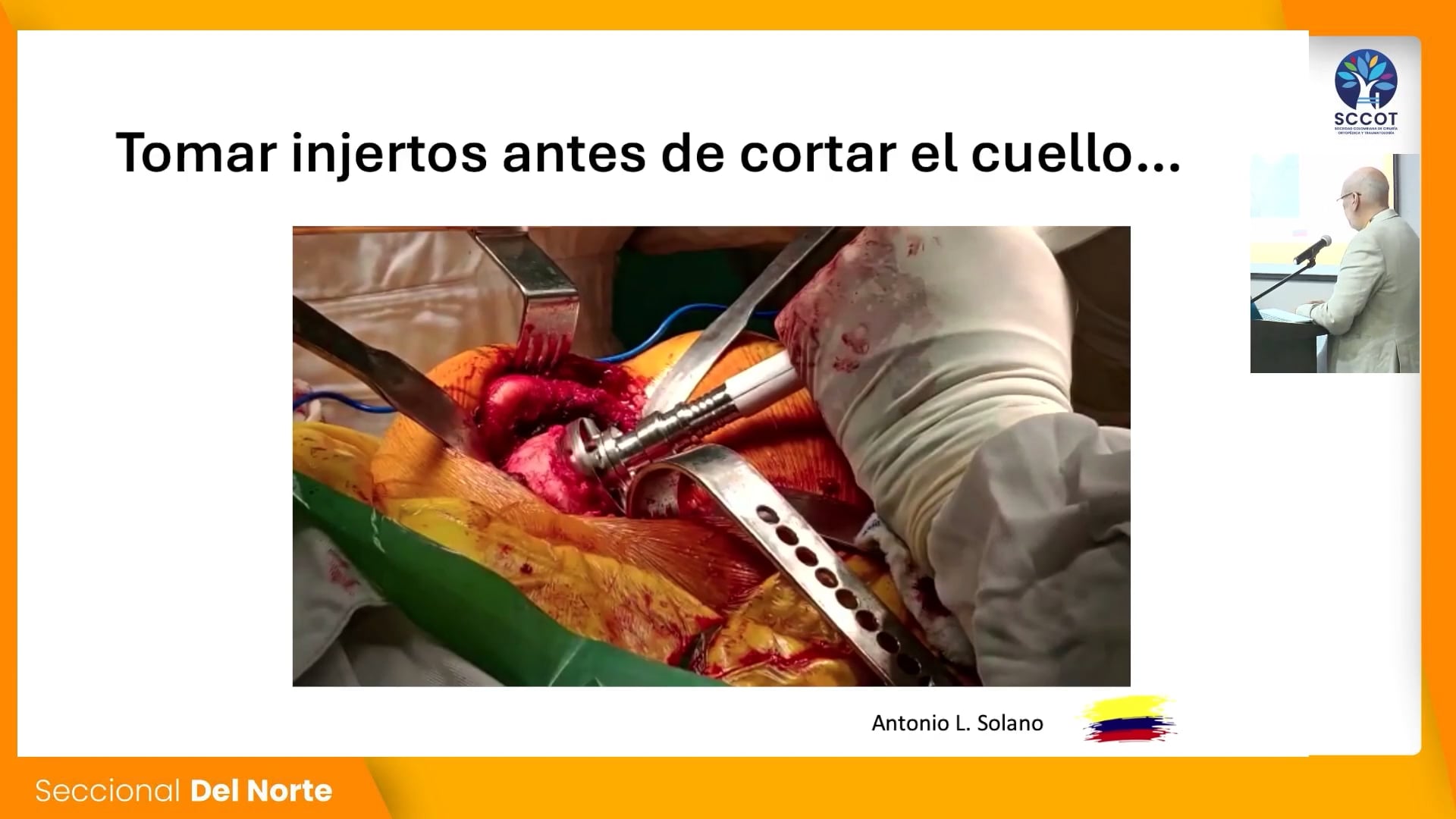 05 CASO Protrusión acetabular