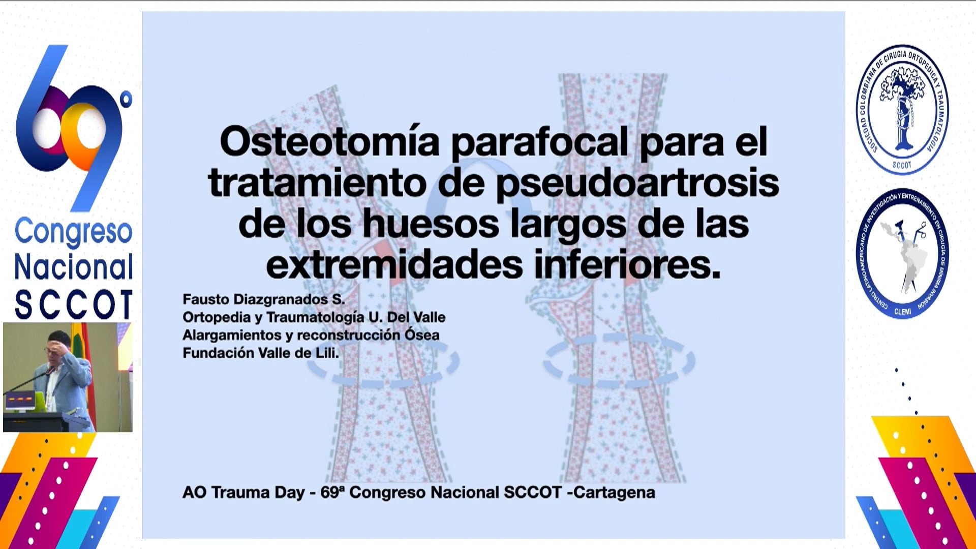 Osteotomía parafocal Por qué funciona y cómo se hace