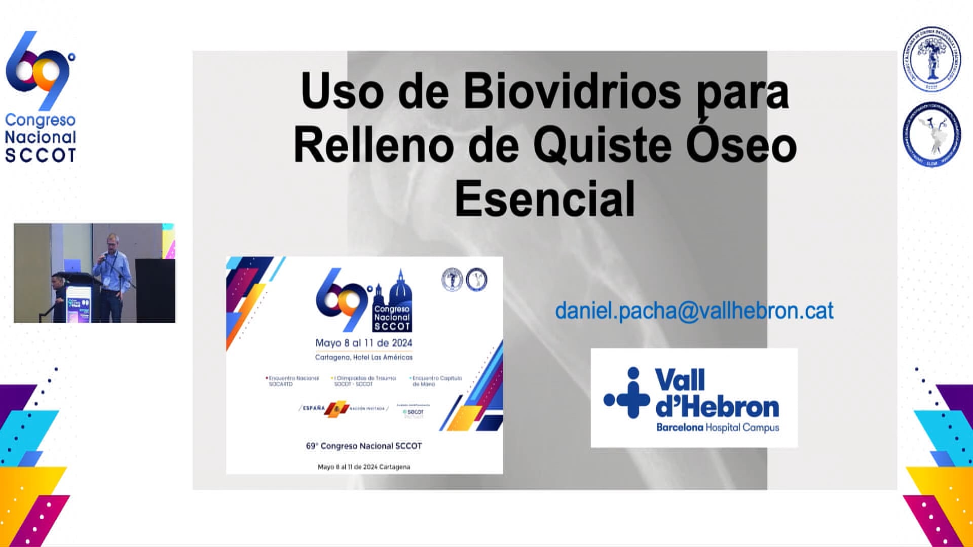 Uso de biovidrios para relleno de quiste óseo simple